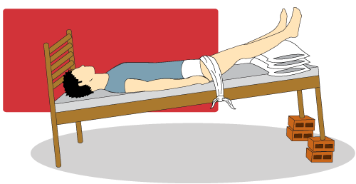 Posição de Trendelemburg