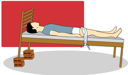 Posição de Trendelemburg