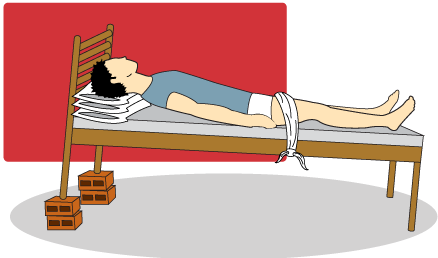 Posição de Trendelemburg