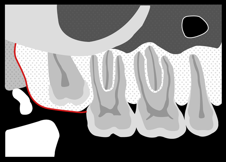 Anatomia da Maxila – Odonto Up